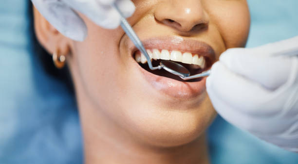 Best Emergency Dentist for Lost Fillings or Crowns in Susanville, CA