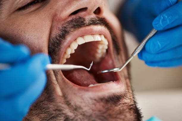 Best Emergency Dentist for Special Needs Patients in Susanville, CA